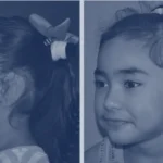 photo of child with ear surgery