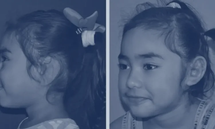 photo of child with ear surgery