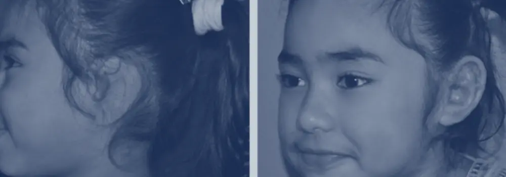 photo of child with ear surgery